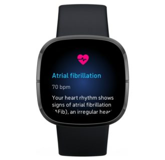 Fitbit’s Sense smartwatch starts getting ECG app updates