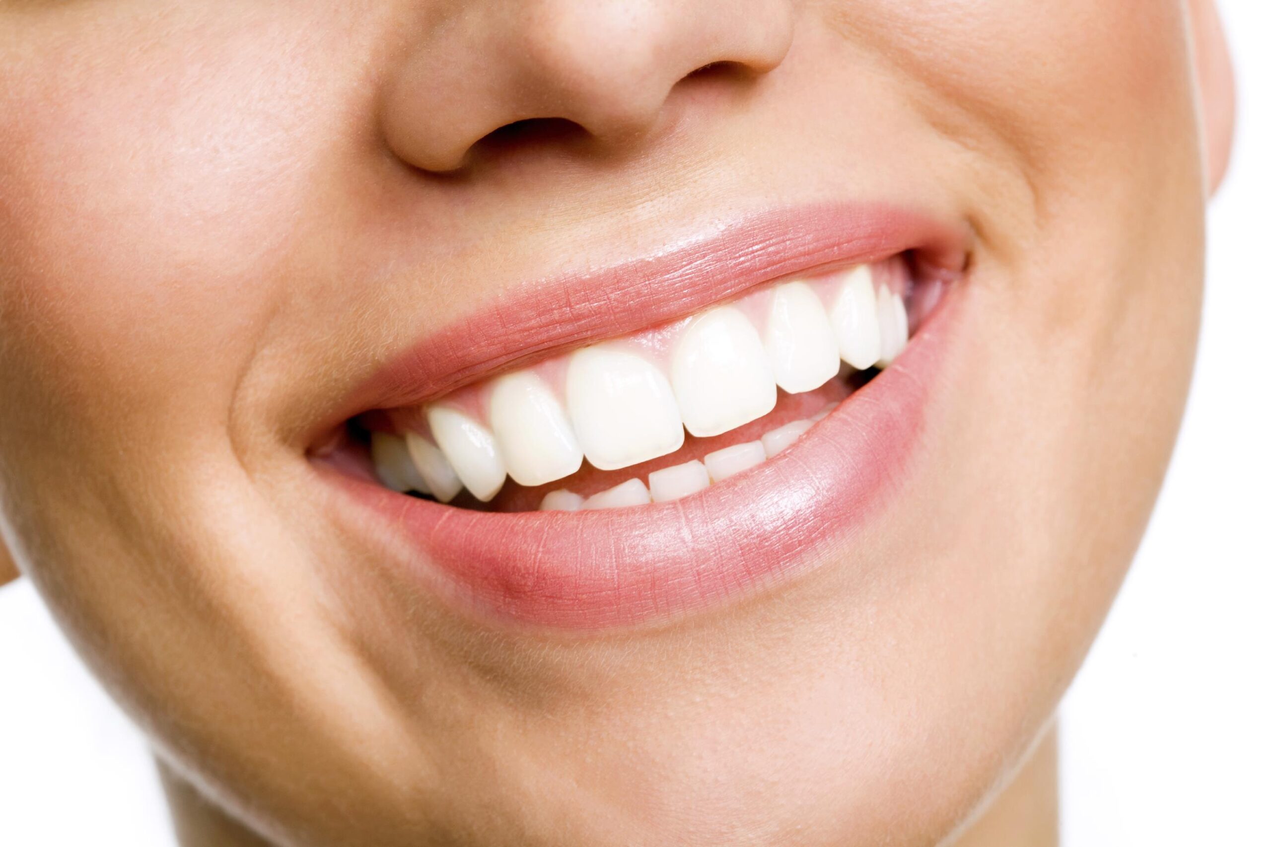 4 Reasons to Whiten Your Teeth with A Dentist Than A DIY Solution