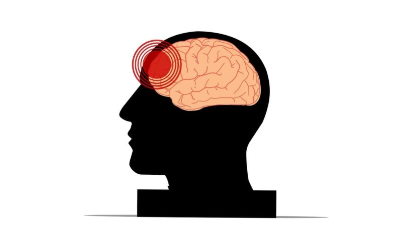 Pain and anxiety should be dealt with immediately after the diagnosis of MS