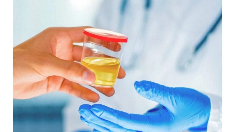 Drug Testing: Overview, Analysis Methods and Research