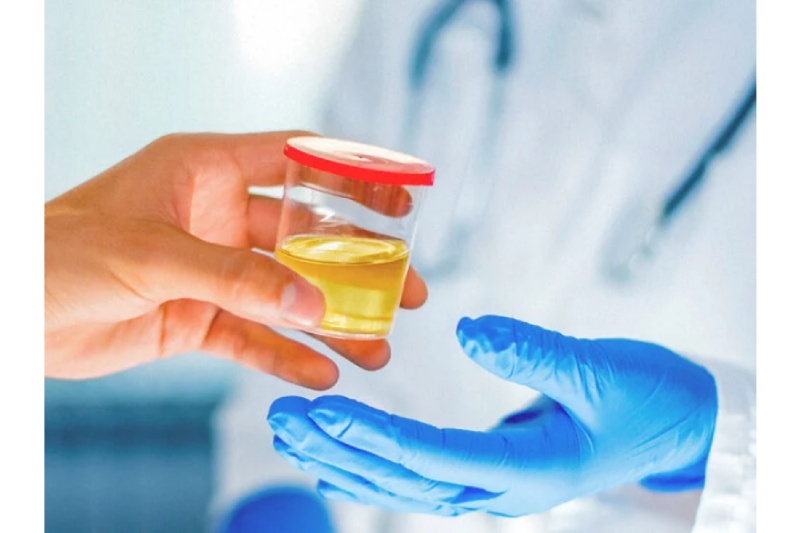 Drug Testing: Overview, Analysis Methods and Research