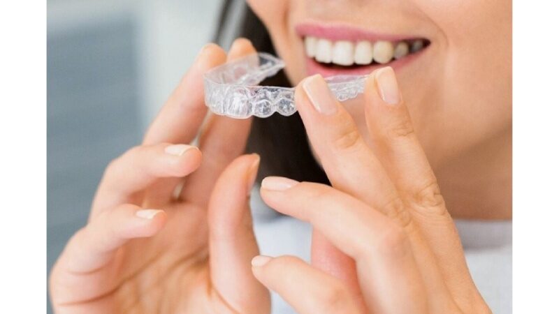 Langley Invisalign: Covering All Basics