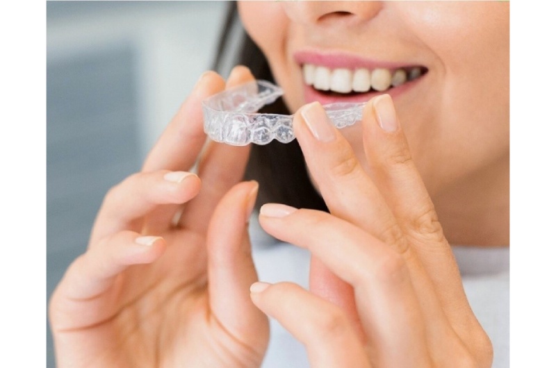 Langley Invisalign: Covering All Basics