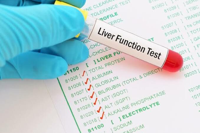 What Tests are Included in Abnormal Liver Function Tests (LFTs)?