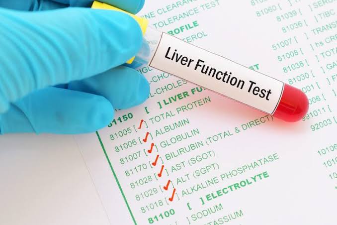 What Tests are Included in Abnormal Liver Function Tests (LFTs)?