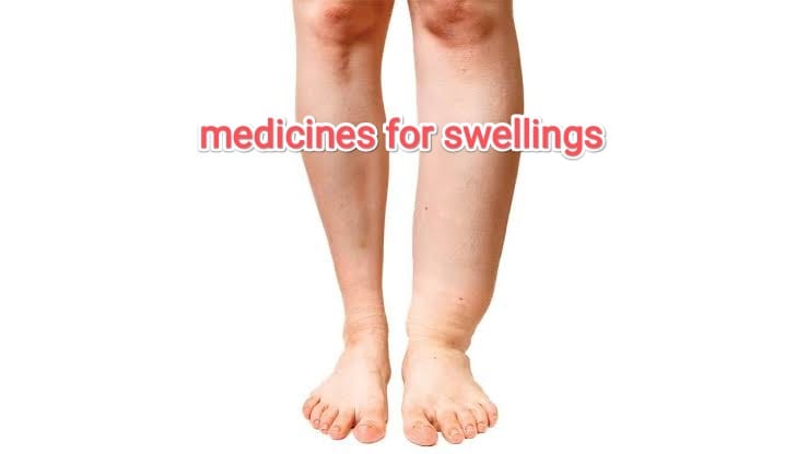5 Medicines That Help Relieve Swelling