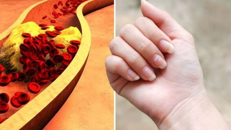 Top 7 Odd Symptoms of Elevated Cholesterol in Men’s Fingers and Hands at Night