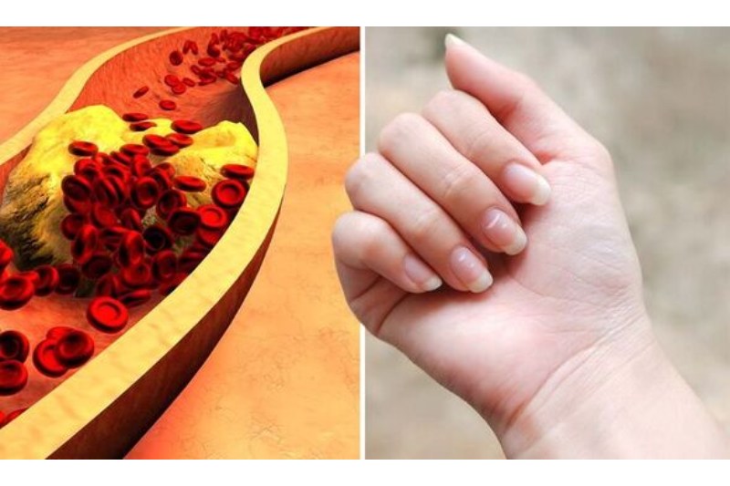 Top 7 Odd Symptoms of Elevated Cholesterol in Men’s Fingers and Hands at Night