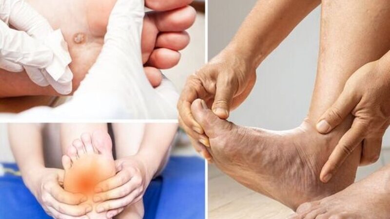Warning Symptoms: Leg and Foot Symptoms at Night due to Cholesterol in Heart Arteries
