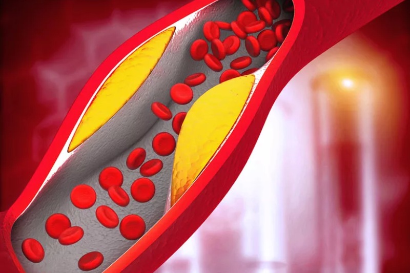 7 Morning Diet Strategies To Lower Blood Pressure And Unclog Arteries