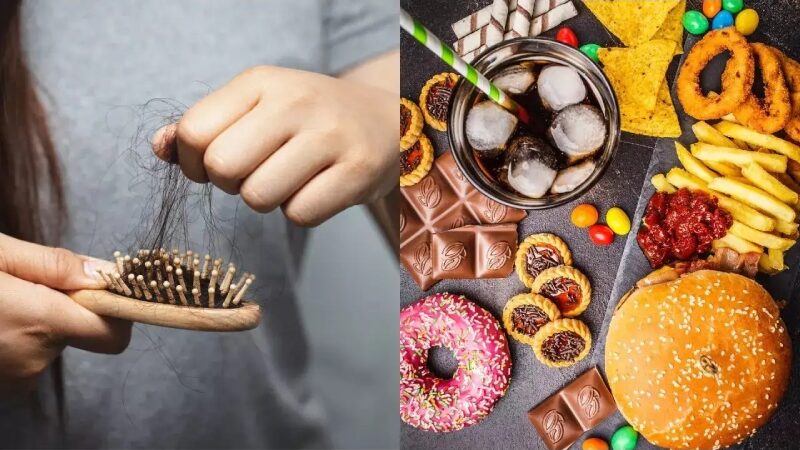 Hair Loss Can be Silently Caused by These Common Foods