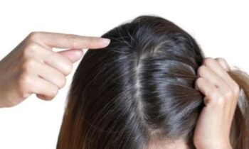 Ayurvedic Herbs for Grey Hair