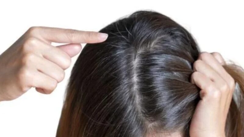 5 Ayurvedic Herbs That Help You Get Young Hair and Reduce Early Greys