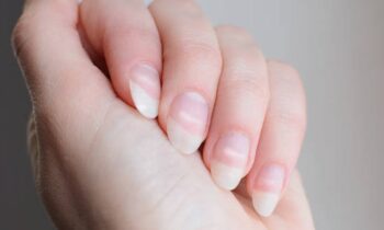 Calcium Deficiency